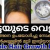 Egg Hair Mask For Hair Growth